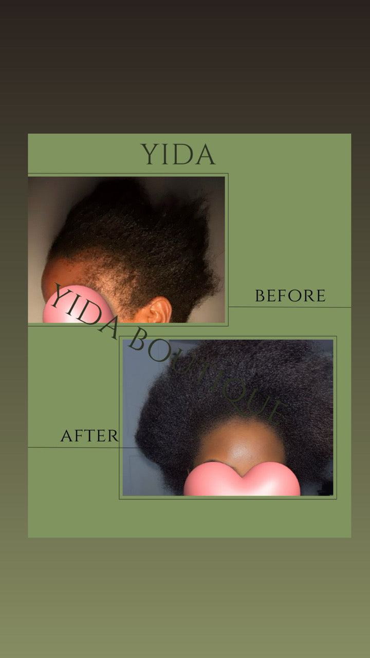 YIDA Huile Capillaire – Huile Botanique de Croissance & Réparation Profonde (120 ml)